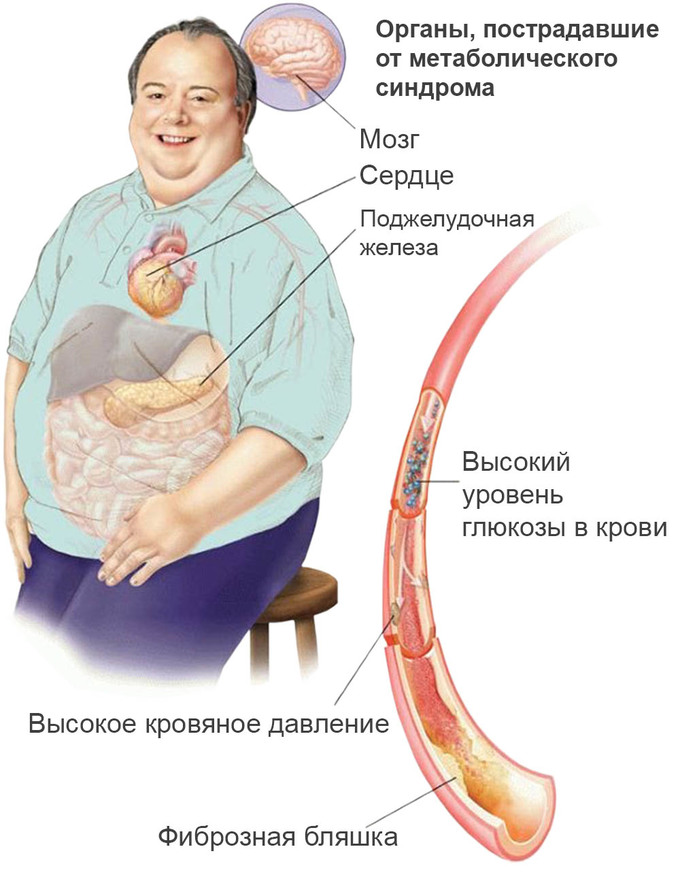Цитрусовые при подагре можно или нет