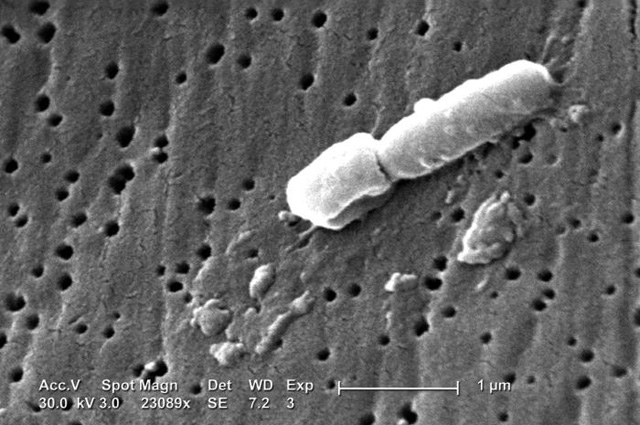 Klebsiella pneumoniae