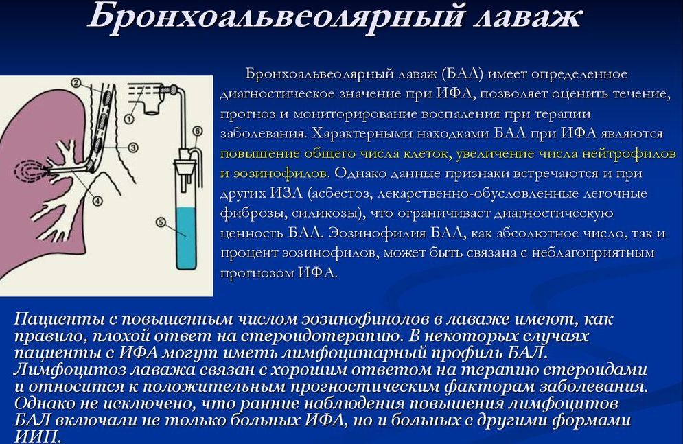 Бронхоальвеолярный лаваж для диагностики пневмонии