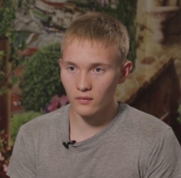 Я стесняюсь своего тела девушка с ожогами лица