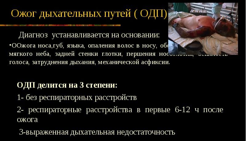 Ожог дыхательных путей (ОДП)