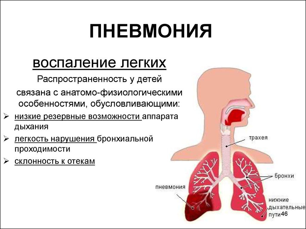 Появление боли в легких после пневмонии