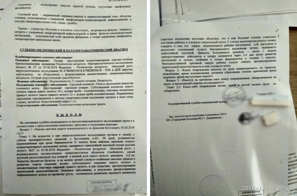1 июня в Дзержинске умер младенец от пневмонии