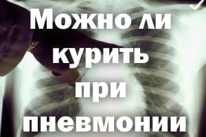 Можно ли курить при пневмонии