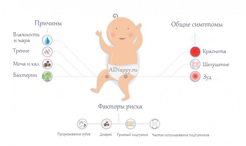 причины