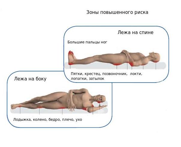 Зоны риска