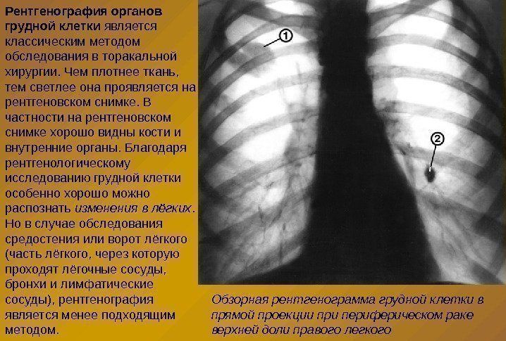 Рентгенография