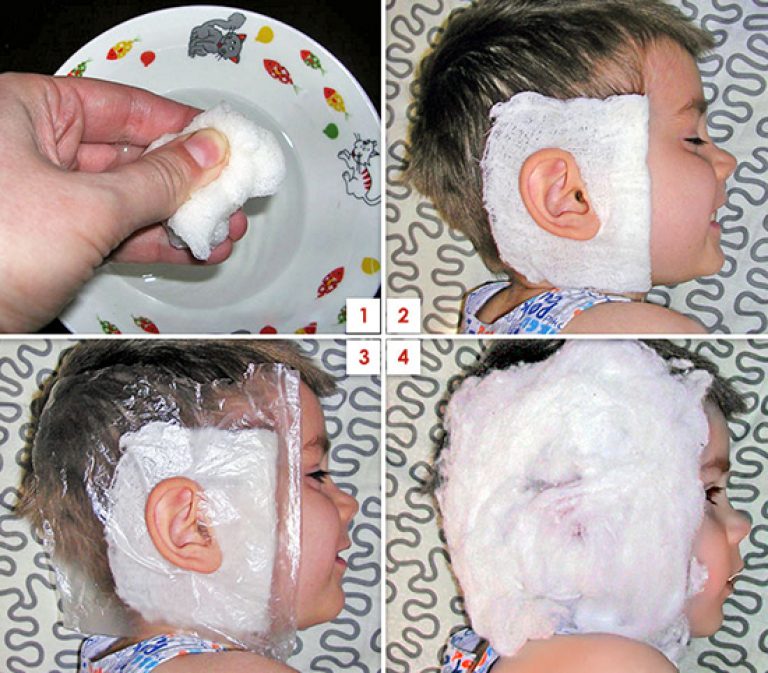 Что можно закапать при отите